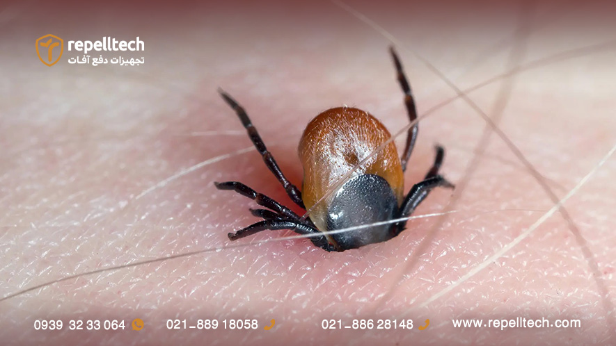 گزش کنه سخت